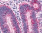 MAS1 / MAS Antibody (C-Terminus)